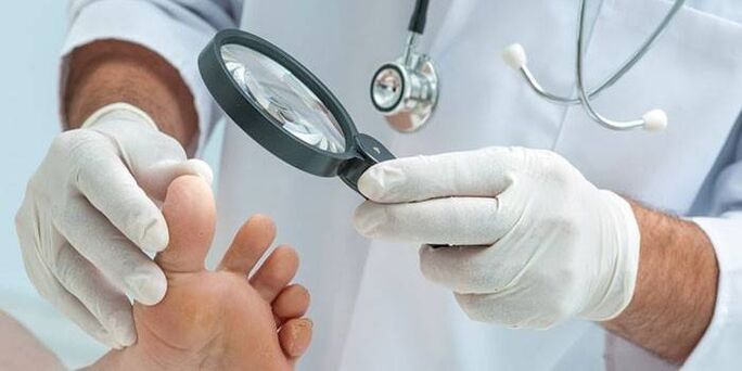 The doctor examines the foot of a patient with a spike with a magnifying glass
