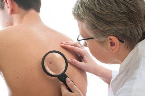 doctor examines papilloma on the back